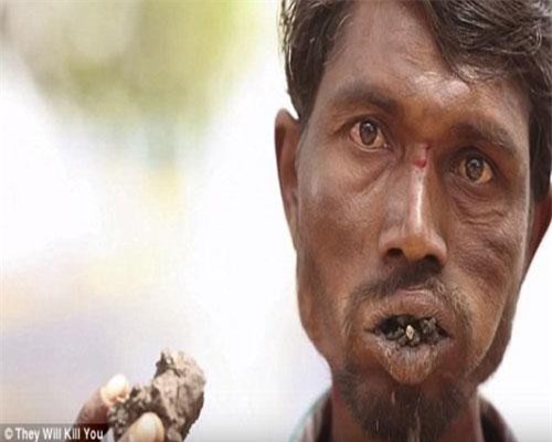 10 căn bệnh kinh dị nhất thế giới, số 1 khiến bạn khiếp vía vì quá đáng sợ