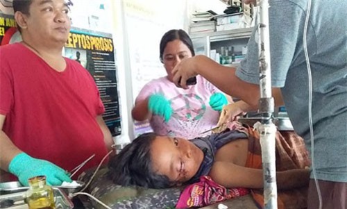 Cá sấu cắn con trai, ông bố Philippines cắn luôn cá sấu