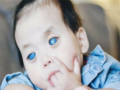 Bé gái có mắt màu xanh bí ẩn và sự thật đau lòng