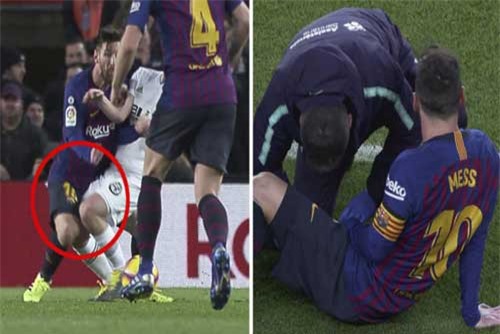 Dính chấn thương, Messi lỡ trận El Clasico?