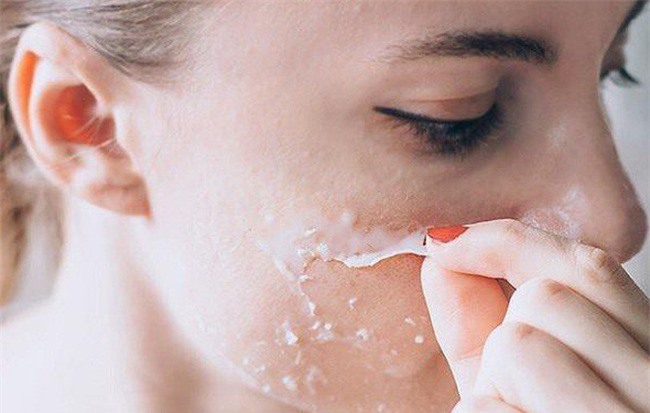 Khổ sở vì da nứt toác, bong tróc giữa thời tiết khắc nghiệt ở Hà Nội thì đây là những giải pháp hữu hiệu giúp bạn khắc phục