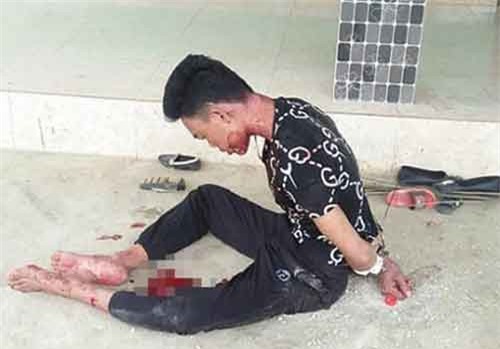 Nghi án chồng giết vợ rồi tự vẫn bất thành