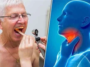Đau họng kéo dài có thể là dấu hiệu ung thư