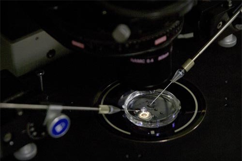 Tìm ra phương pháp loại bỏ triệt để virus HPV