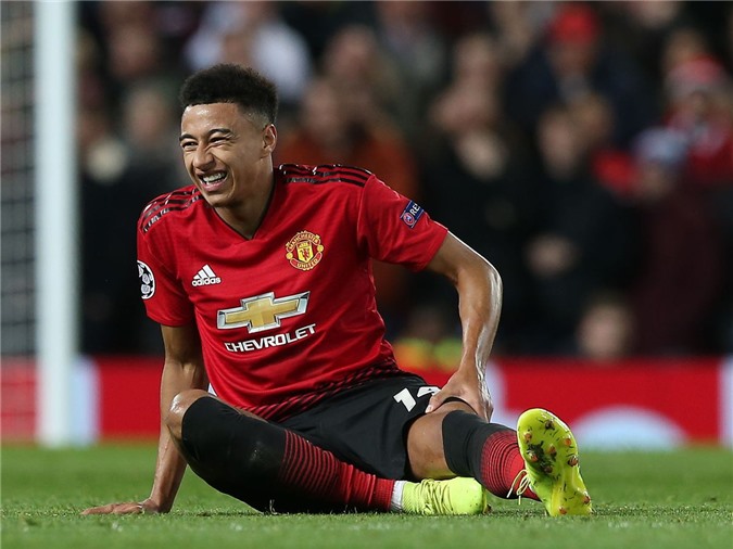 Chính thức: Martial, Lingard nghỉ 3 tuần vì chấn thương