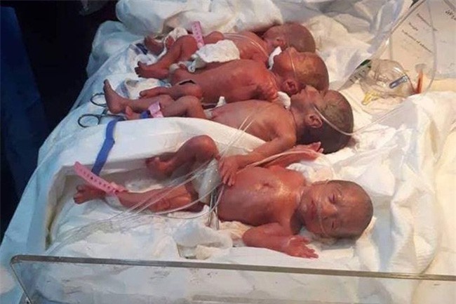 Chuyện lạ mà có thật: Bà mẹ vượt cạn với số lượng con "khủng" chưa từng thấy, nghe xong ai cũng ngã ngửa