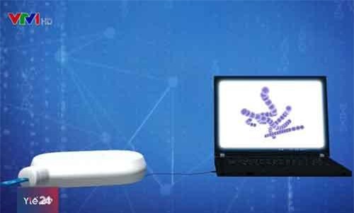 Thiết bị nhỏ gọn chẩn đoán nhiễm trùng trong vài phút