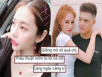 Linh Chi đáp trả khi bị chê phẫu thuật thẩm mỹ lỗi, miệng trông giống mỏ vịt