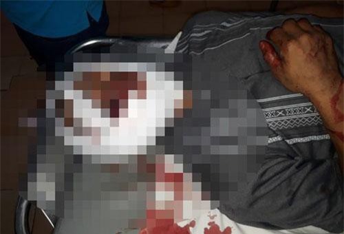 Gia Lai: Mâu thuẫn khi bàn chuyện làm ăn, một người bị đánh tử vong