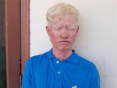 Bị sờ tóc trong bàn nhậu, anh dùng gậy đánh chết em ruột