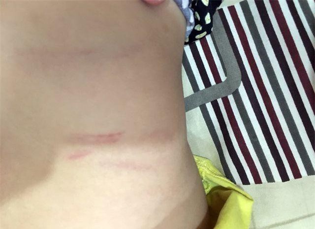 Con bị cô giáo đánh, phụ huynh yêu cầu bồi thường từ 10 triệu “nhảy” lên 100 triệu đồng