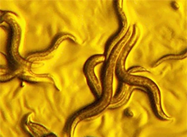 Phát hiện ra loại vi khuẩn “vàng” có khả năng “tiêu diệt” giun ký sinh - 1
