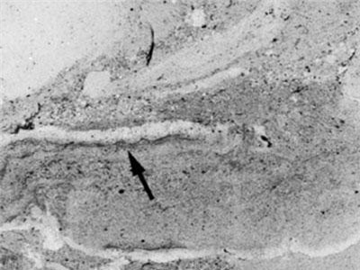 Phát hiện hoá thạch giun 500 triệu năm tuổi dưới đáy biển cổ đại