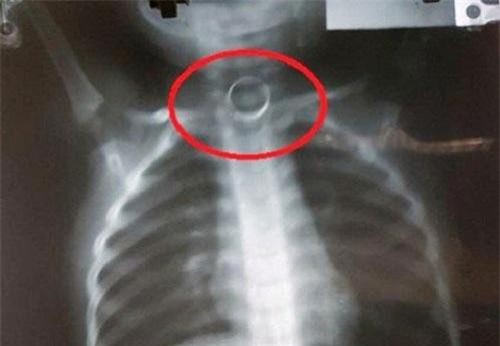 Đồng Nai: Bé 2 tuổi tử vong sau bữa ăn sáng ở nhà trẻ