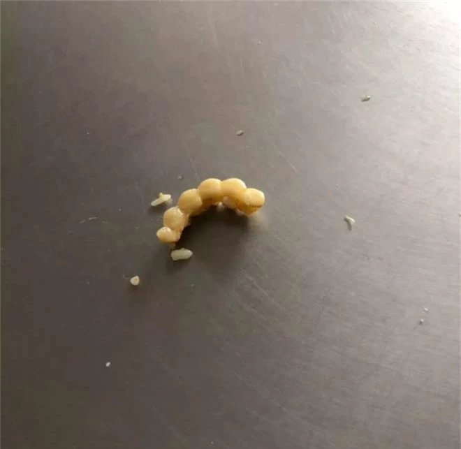 Đang ăn cơm ngon lành ở căng tin, nữ sinh Trung Quốc phát hiện trong bát mình có một đoạn... răng giả! - Ảnh 4.