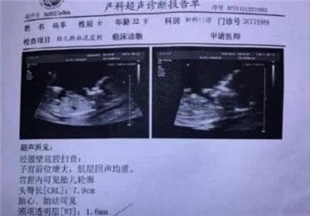 Xôn xao thông tin Dương Mịch đang mang thai sau 3 tháng ly hôn, bố đứa trẻ là diễn viên nổi tiếng - Ảnh 2.