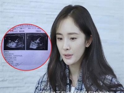 Xôn xao thông tin Dương Mịch đang mang thai sau 3 tháng ly hôn, bố đứa trẻ là diễn viên nổi tiếng