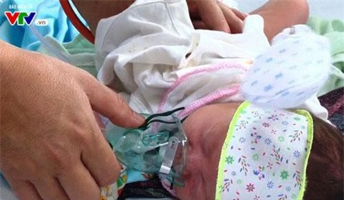 Những điều cần lưu ý khi trẻ mắc sởi