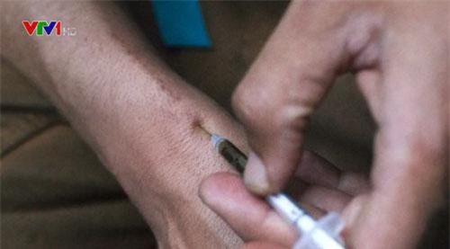 Ứng dụng ngăn tử vong do dùng ma túy quá liều