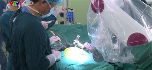 Ứng dụng robot trong phẫu thuật thần kinh