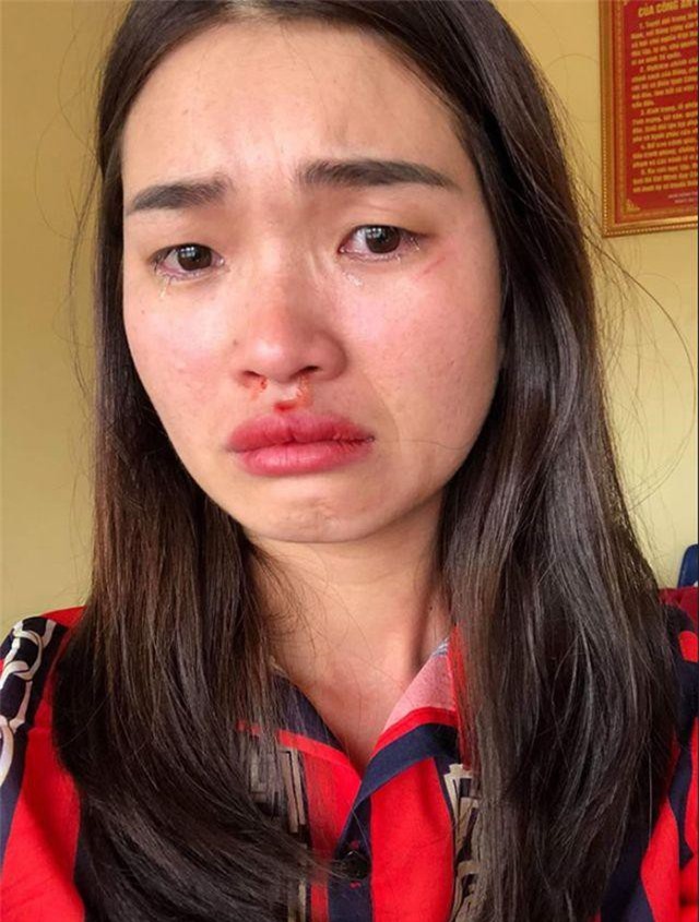 Chủ “nhà xe đầu gấu” đánh nữ hành khách ra trình diện công an