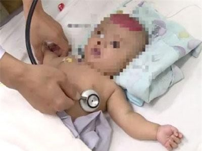 Điện thoại rơi trúng đầu, bé 3 tháng suýt tử vong