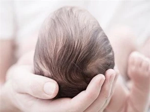 Rụng tóc vành khăn ở trẻ sơ sinh có phải là bệnh lý? Điều trị ra sao?