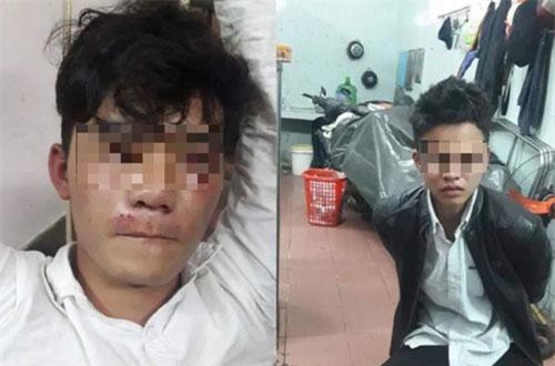 Đà Nẵng: Khởi tố 2 đối tượng ném gạch vào công an đang làm nhiệm vụ