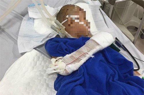 Quảng Bình: Kẻ “ngáo đá” dùng dao chém liên tiếp vào đầu bé trai 9 tuổi