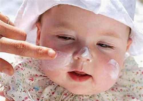 Rôm sảy là gì? Cách phòng tránh và chữa trị rôm sảy hiệu quả