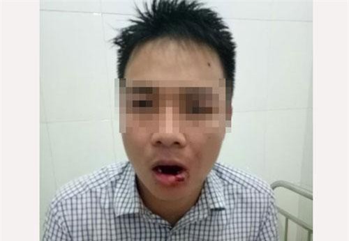 Hà Tĩnh: Khởi tố thầy giáo ném thanh sắt khiến nhân viên tòa… gãy 5 răng