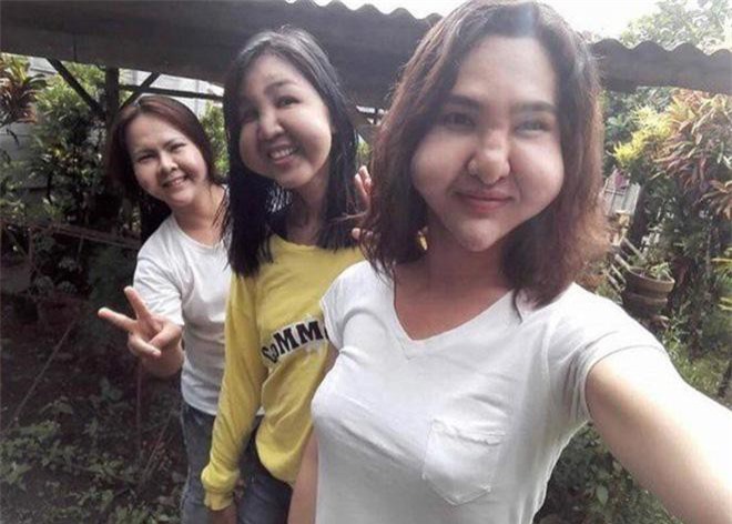 Đôi bạn thân rủ nhau thẩm mỹ chui và cùng biến thành phù thủy