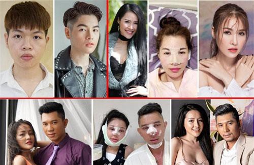 Những sao Việt không ngại công khai phẫu thuật thẩm mỹ