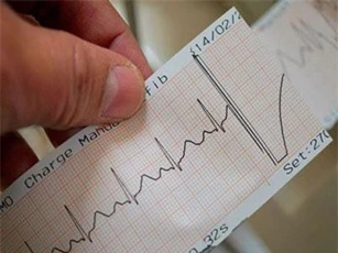 Nhịp tim như thế nào thì nguy hiểm?