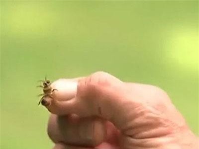 Bị ong đốt, người phụ nữ 61 tuổi nhồi máu cơ tim cấp