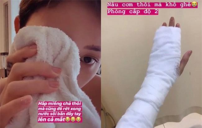 Lâu lâu mới lại xắn tay vào bếp trổ tài nữ công gia chánh, Tóc Tiên bị bỏng cấp độ 2 phải đi bệnh viện băng bó