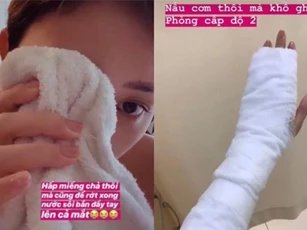 Lâu lâu mới lại xắn tay vào bếp trổ tài nữ công gia chánh, Tóc Tiên bị bỏng cấp độ 2 phải đi bệnh viện băng bó