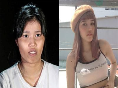 Cô gái 22 tuổi từng bị chê "về Bến Tre nạo dừa" và cuộc đại phẫu để thay đổi nhan sắc khiến bố chẳng nhận ra con gái