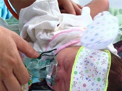 Làm gì khi trẻ chưa đến tuổi tiêm vaccine mắc sởi