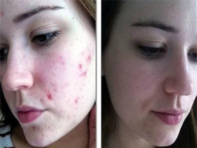 Là "thế hệ thiếu ngủ", bảo sao 9x hay gặp phải các tình trạng dưới đây