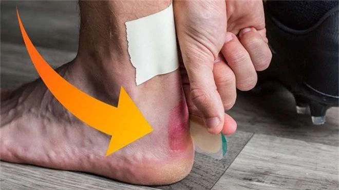 Cẩn thận với 6 dấu hiệu khác thường ở bàn chân đang ngầm cảnh báo bệnh - Ảnh 1.