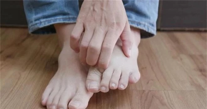 Cẩn thận với 6 dấu hiệu khác thường ở bàn chân đang ngầm cảnh báo bệnh - Ảnh 7.