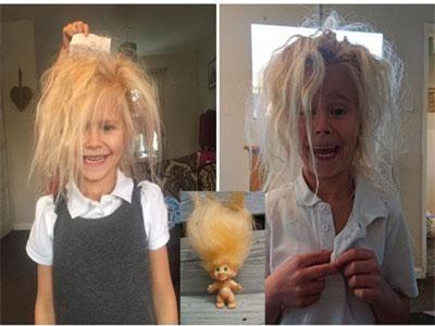 Mắc hội chứng lạ khiến tóc vừa cứng, vừa bông lại còn xù lên lởm chởm thế nhưng cô bé này vẫn không ngừng gây sốt