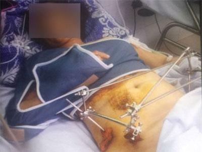 Long An: Hai tuần nỗ lực truy tìm tài xế gây tai nạn nghiêm trọng rồi bỏ trốn