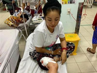 Danh hài Thúy Nga gặp tai nạn phải khâu gần 10 mũi