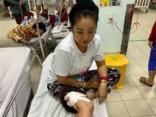 Danh hài Thúy Nga gặp tai nạn phải khâu gần 10 mũi