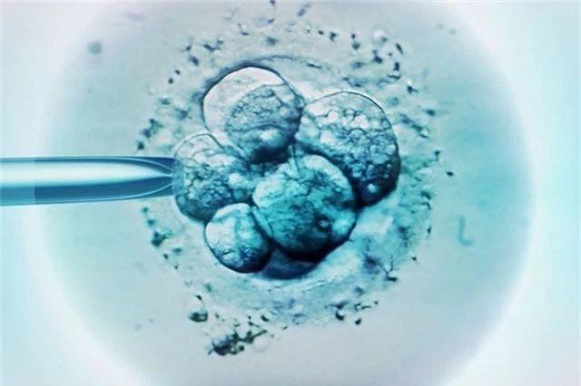 Trẻ sinh ra nhờ thụ tinh nhân tạo có nhiều khả năng mắc bệnh ung thư hơn? - 1