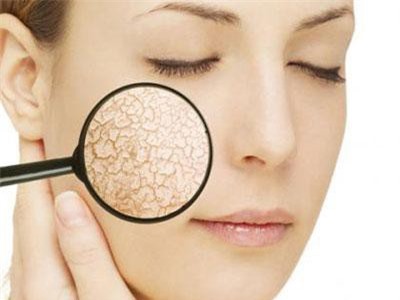 10 biểu hiện “lạ” ở da có thể là báo hiệu một căn bệnh nghiêm trọng