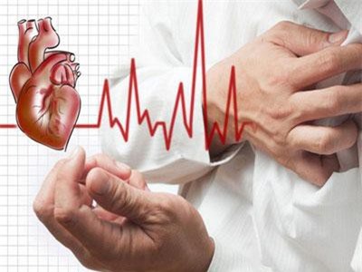 Những nguyên nhân gây đột quỵ