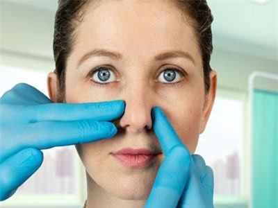 Phẫu thuật chỉnh hình mũi chỉ mất… 5 phút